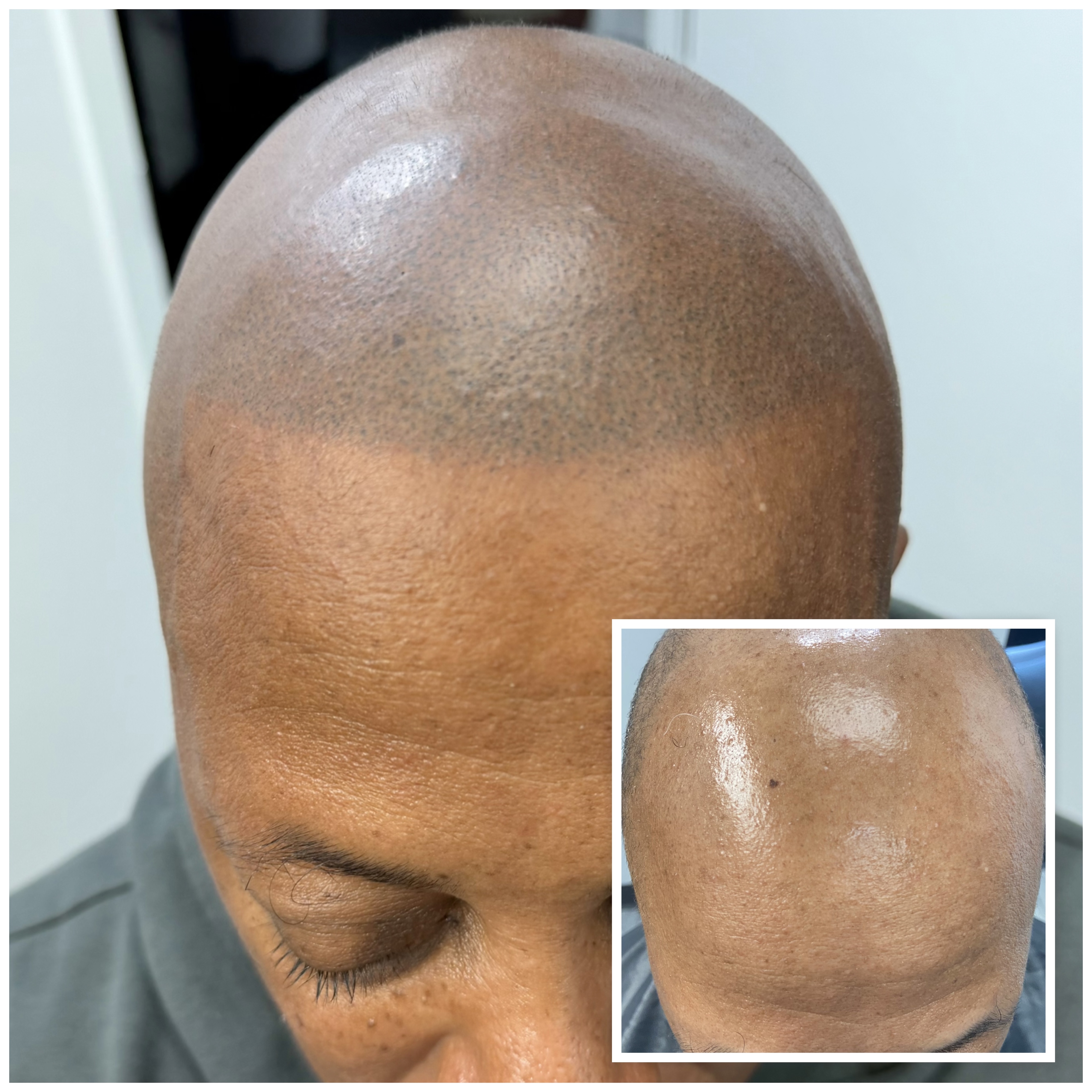 Skalp Ink Micropigmentation