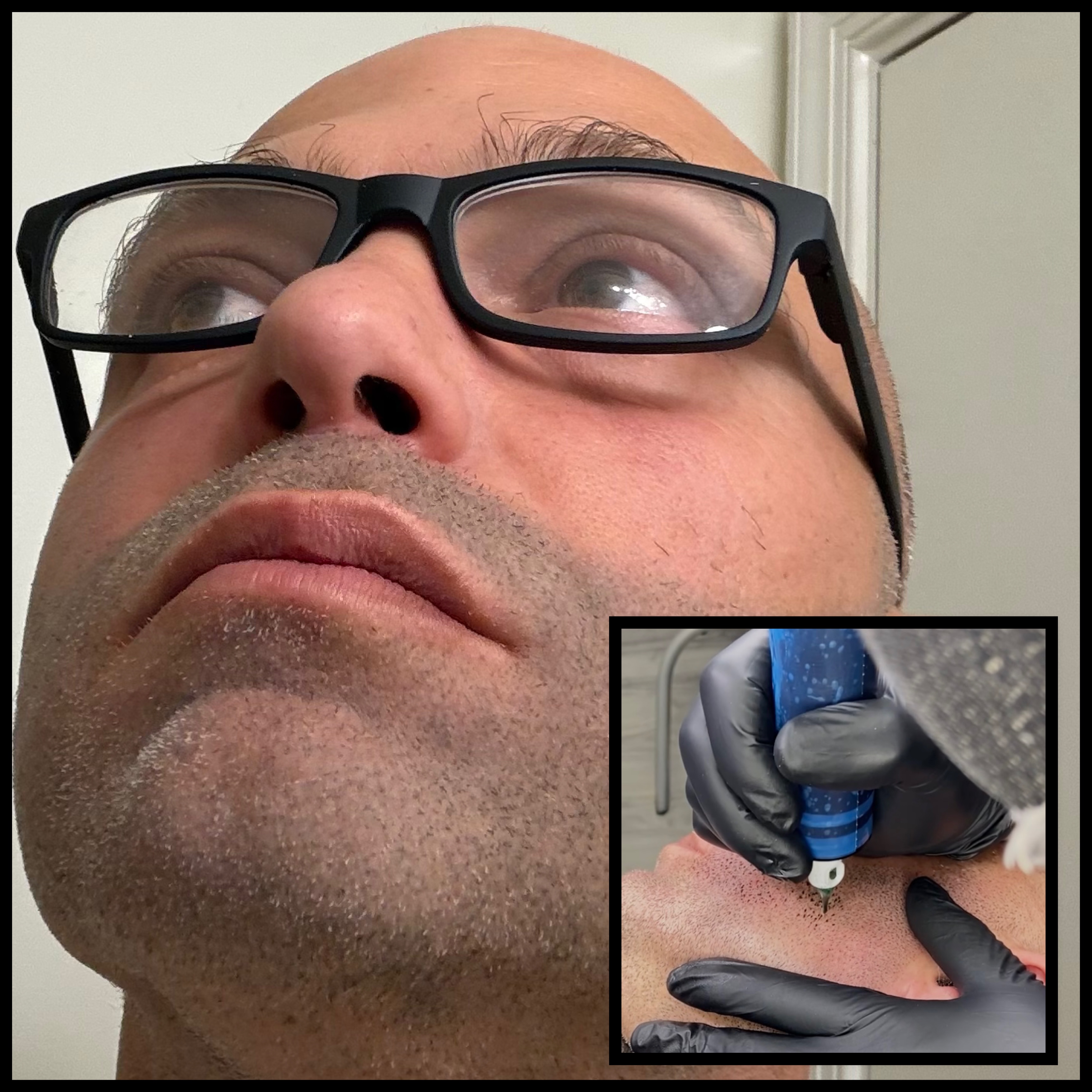 Skalp Ink Micropigmentation