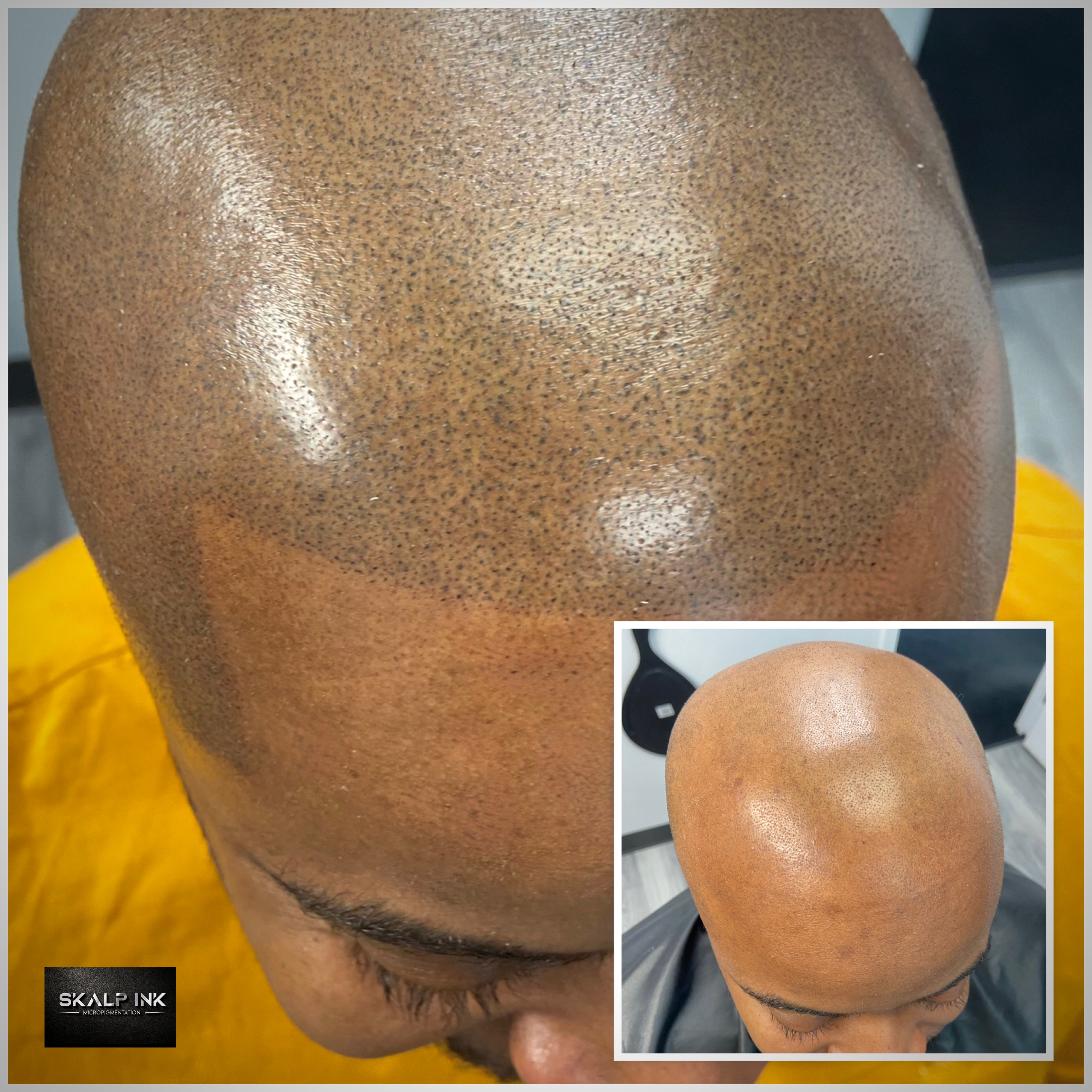 Skalp Ink Micropigmentation