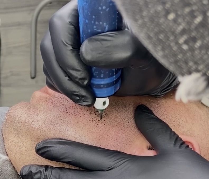 Skalp Ink Micropigmentation