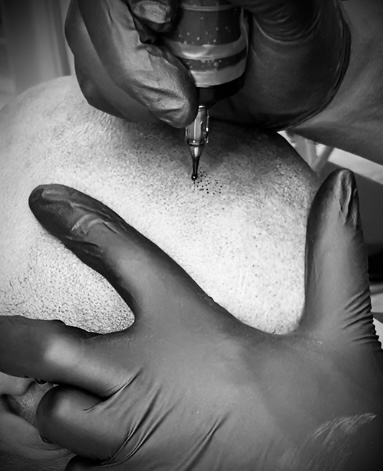 Skalp Ink Micropigmentation