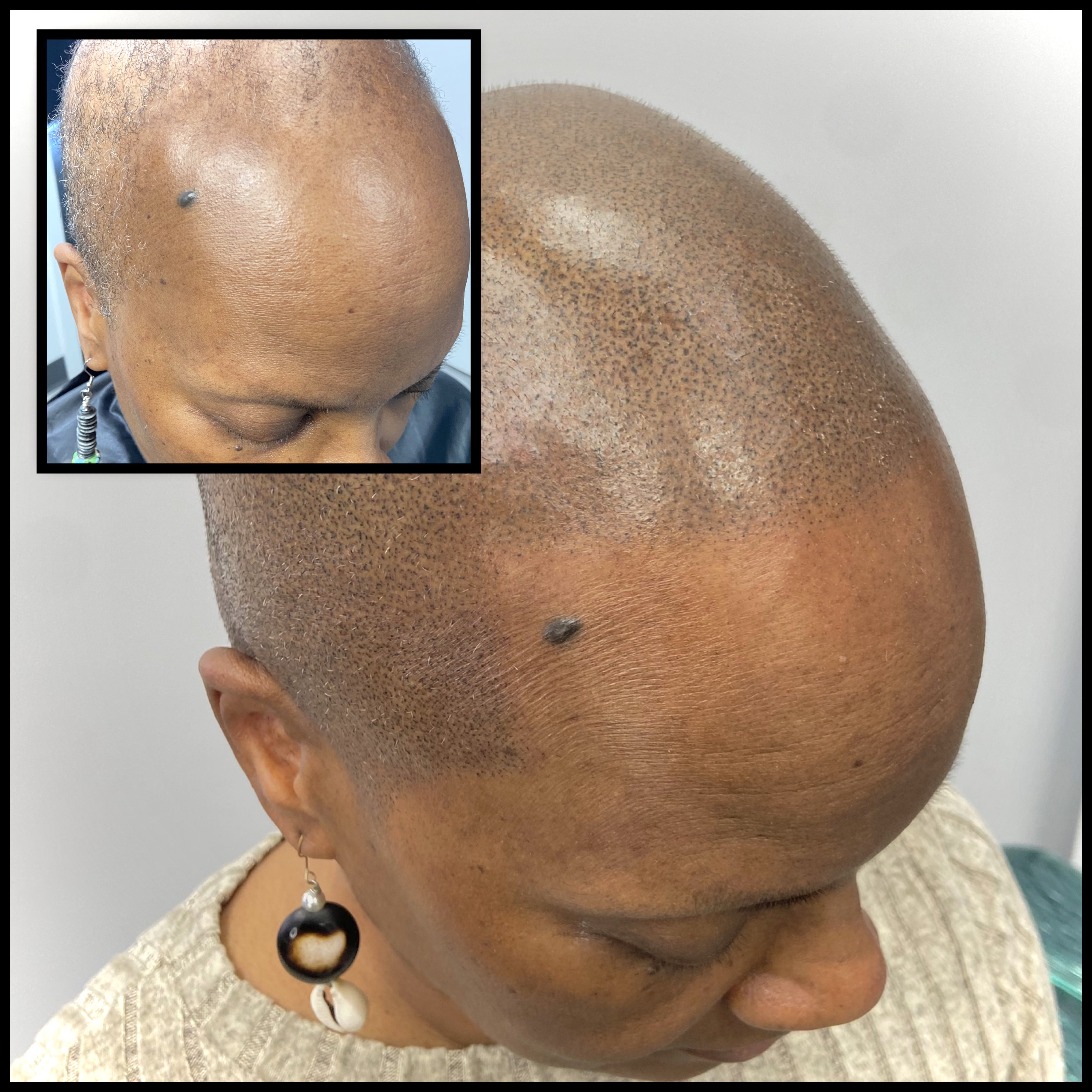 Skalp Ink Micropigmentation