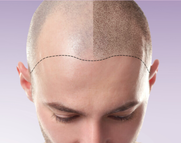 Subtle Solutions SMP