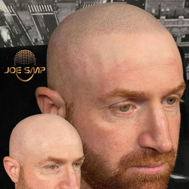 Philadelphia Scalp Works