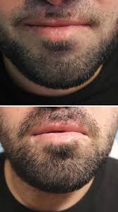 Subtle Solutions SMP