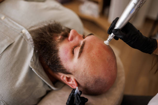 Precision SMP Clermont